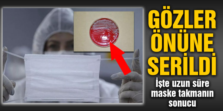 Gözler önüne serildi! İşte uzun süre maske kullanmanın sonucu