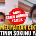 Estetik ameliyat oldu, hayatı kabusa döndü!