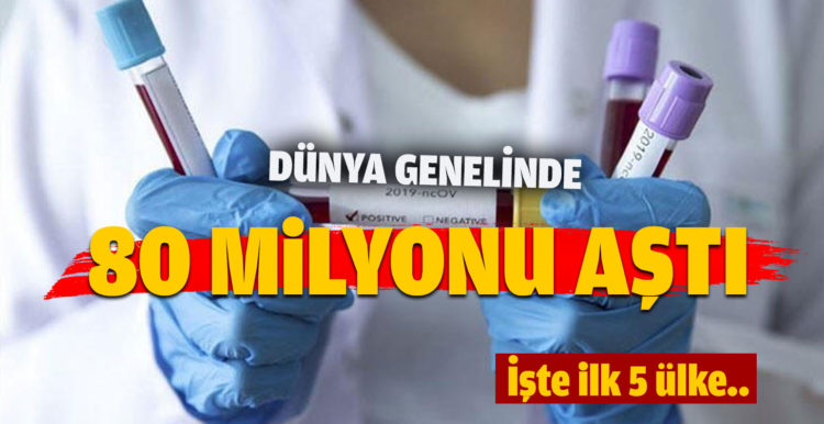 Dünya genelinde vaka sayısı 80 milyonu aştı