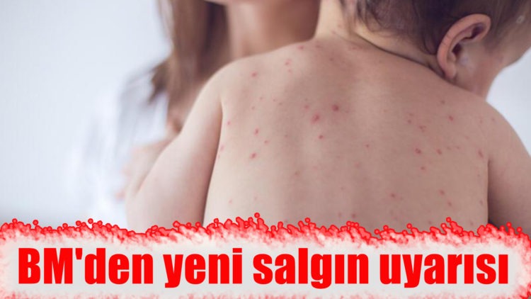 BM’den yeni salgın uyarısı
