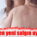 BM’den yeni salgın uyarısı
