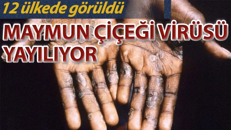 Maymun çiçeği virüsü alarmı: 12 ülkede görüldü