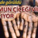 Maymun çiçeği virüsü alarmı: 12 ülkede görüldü