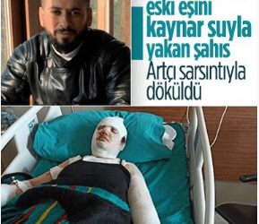 Hatay’da depremzede kadın, eski eşi tarafından kaynar suyla yakıldı