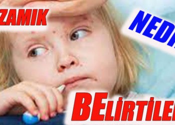 Kızamık nedir? Kızamık belirtileri nelerdir? 