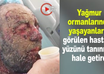 YAĞMUR ORMANLARINDA ÖZGÜ HASTALIK TÜRK’Ü BULDU