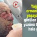 YAĞMUR ORMANLARINDA ÖZGÜ HASTALIK TÜRK’Ü BULDU