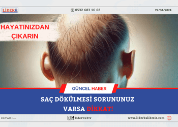 SAÇ DÖKÜLMESİ SORUNUNUZ VARSA DİKKAT!