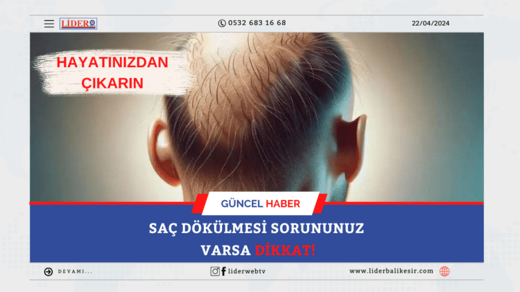 SAÇ DÖKÜLMESİ SORUNUNUZ VARSA DİKKAT!
