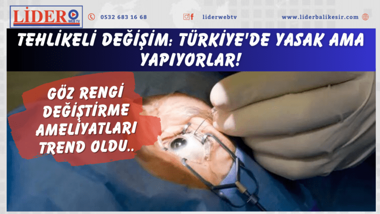 Tehlikeli değişim: Türkiye’de yasak ama yapıyorlar! Göz rengi değiştirme ameliyatları trend oldu