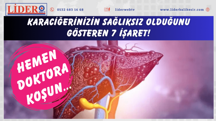 Karaciğerinizin sağlıksız olduğunu gösteren 7 işaret! Hemen doktora koşun…