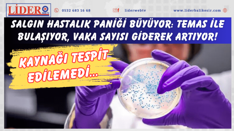 Salgın hastalık paniği büyüyor: Temas ile bulaşıyor, vaka sayısı giderek artıyor! Kaynağı tespit edilemedi