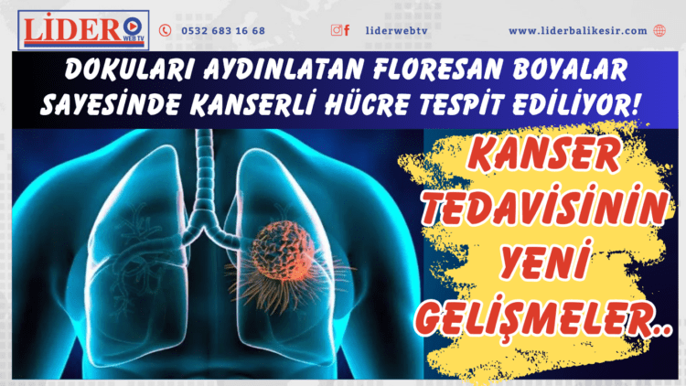 Dokuları aydınlatan floresan boyalar sayesinde kanserli hücre tespit ediliyor! Kanser tedavisinin yeni gelişmeler..