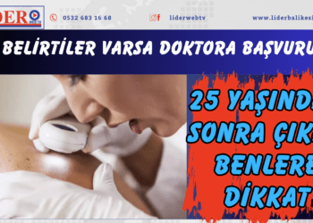 Bu belirtiler varsa doktora başvurun! 25 yaşından sonra çıkan benlere dikkat..