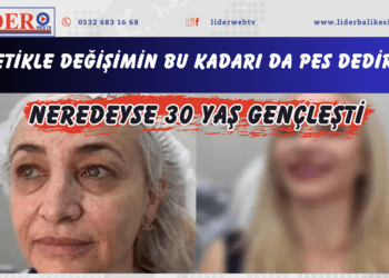 Estetikle değişimin bu kadarı da pes dedirtti! Neredeyse 30 yaş gençleşti
