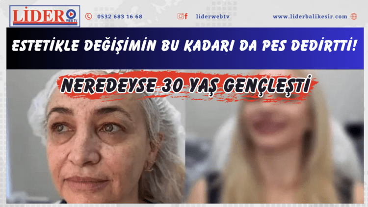 Estetikle değişimin bu kadarı da pes dedirtti! Neredeyse 30 yaş gençleşti