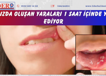Ağızda oluşan yaraları 1 saat içinde yok ediyor