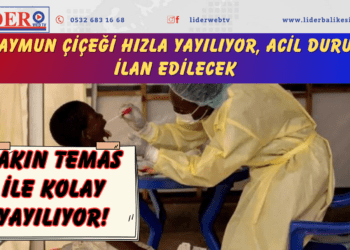 Maymun çiçeği hızla yayılıyor, acil durum ilan edilecek