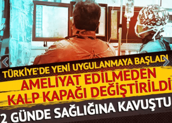 Ameliyat edilmeden kalp kapağı değiştirildi!