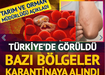 O hastalık Türkiye’de görüldü! Bazı bölgeler karantina altına alındı!
