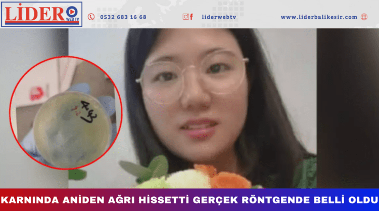 Karnında aniden ağrı hissetti,gerçek röntgende belli oldu