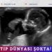 Tıp dünyası şokta!