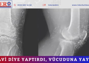 Tedavi diye yaptırdı, vücuduna yayıldı!