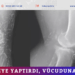 Tedavi diye yaptırdı, vücuduna yayıldı!