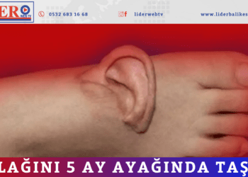 Kulağını 5 ay ayağında taşıdı