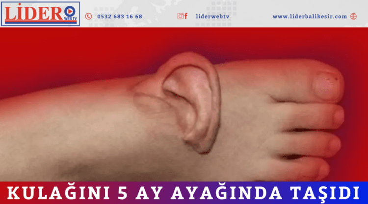 Kulağını 5 ay ayağında taşıdı