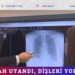 Sabah uyandı, dişleri yoktu!