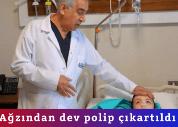  Ağzından dev polip çıkartıldı