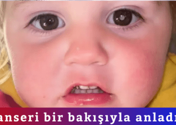 Kanseri bir bakışıyla anladı! Fotoğrafta beyaz parıltı görünce…